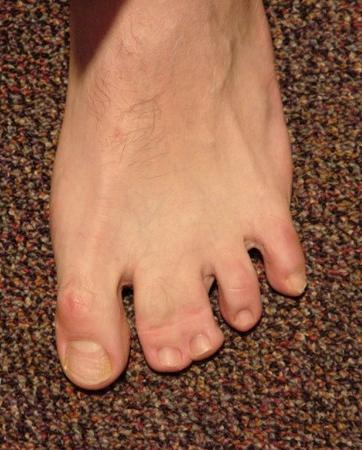 error displaying image