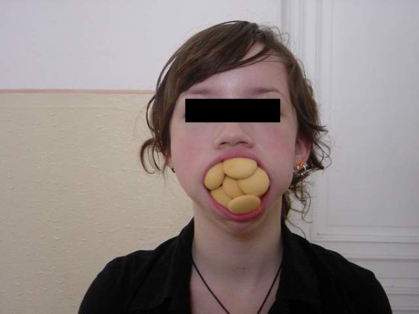 error displaying image