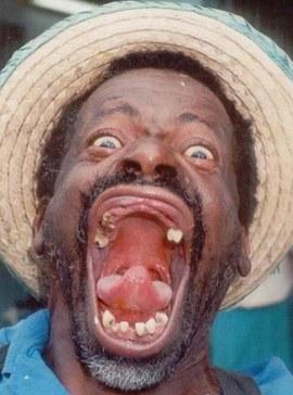 error displaying image