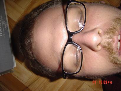 error displaying image