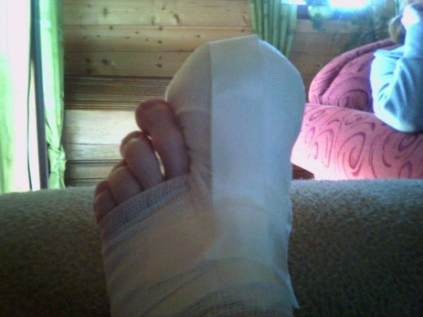 error displaying image