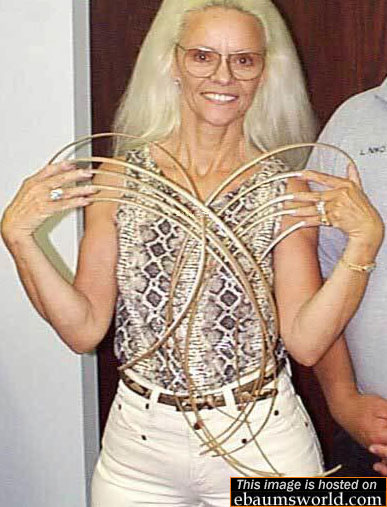 error displaying image