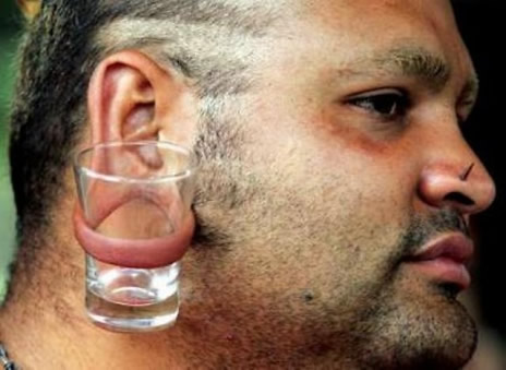 error displaying image