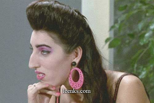 error displaying image