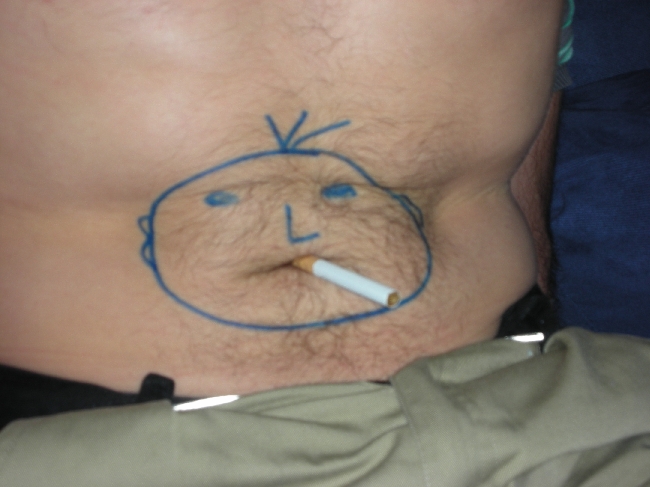 error displaying image