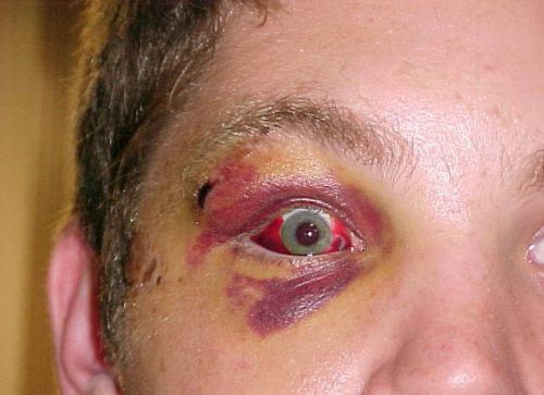 error displaying image