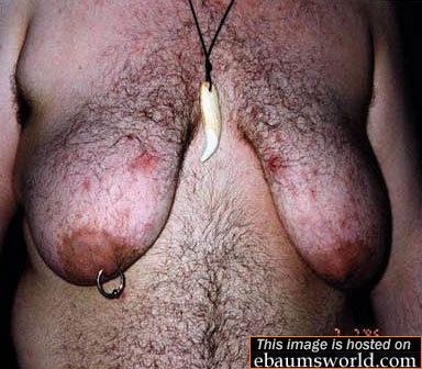 error displaying image