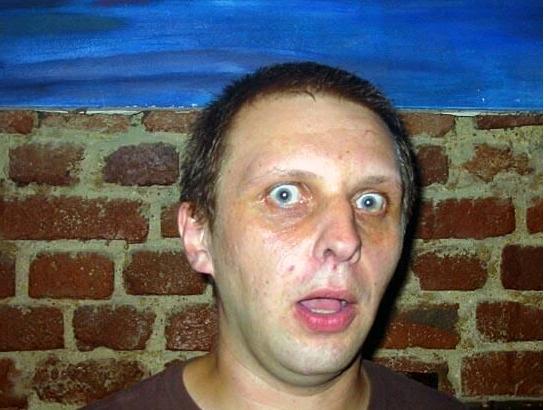 error displaying image