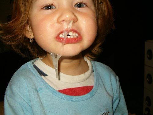 error displaying image